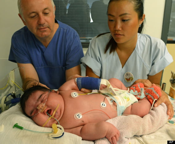 Nace bebé de más de 6 kilos en Alemania Germany Heavy Newborn