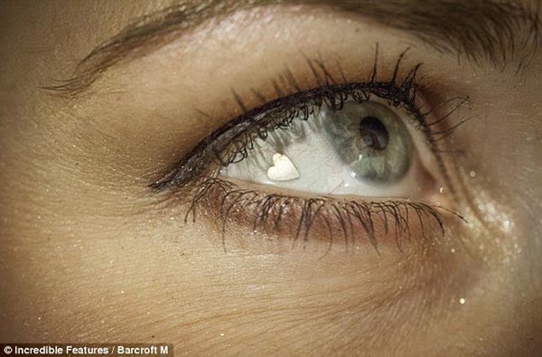 Implantes de platino en los ojos, la nueva moda estética corazon de platino en el ojo (3)