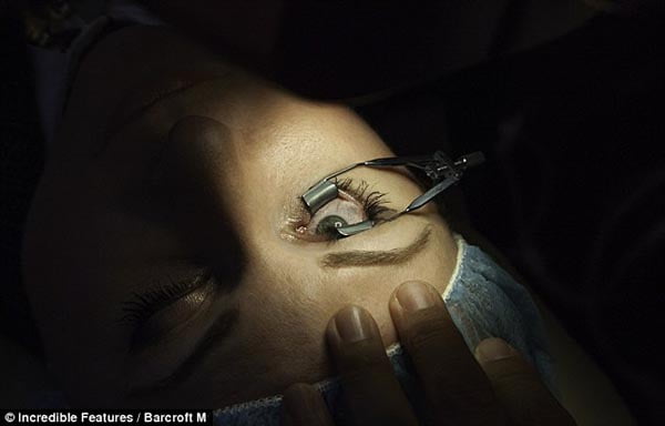 Implantes de platino en los ojos, la nueva moda estética corazon de platino en el ojo 4